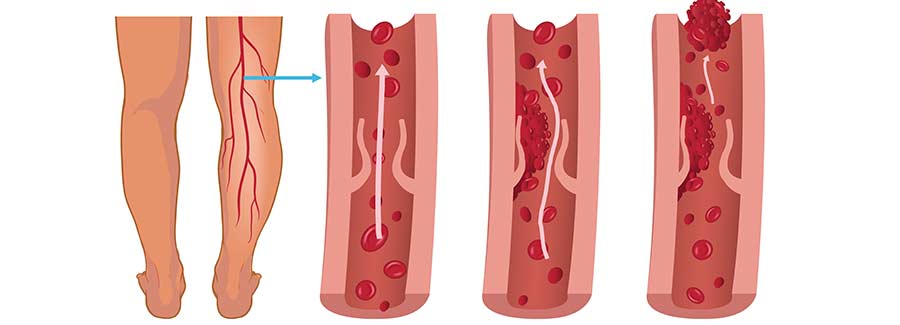 Les avantages de la méthode AVALL